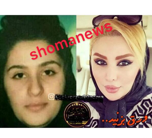 عکس دنیا قبل عمل