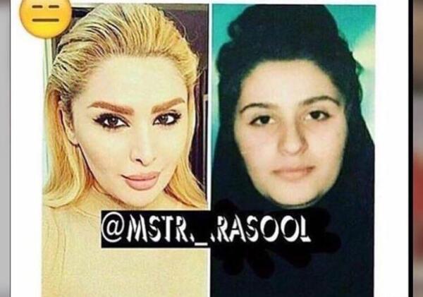 عکس دنیا قبل عمل
