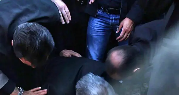 عکس عارف لرستانی قبل عمل