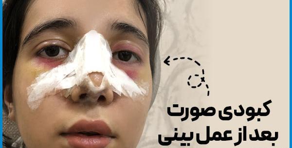 عکس کبودی صورت