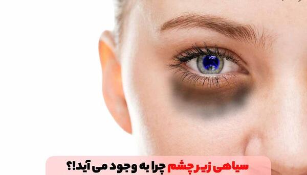 عکس کبودی صورت