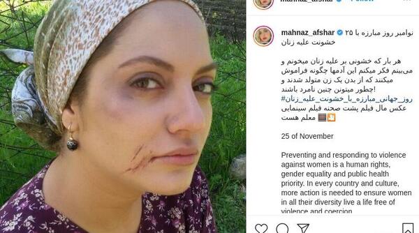 عکس کبودی صورت