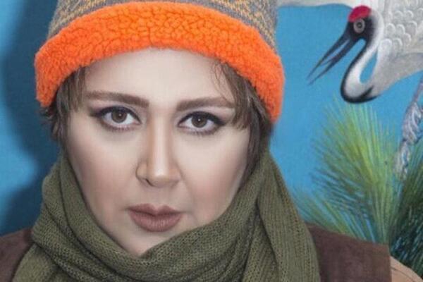 عکس قبل و بعد شهره لرستانی