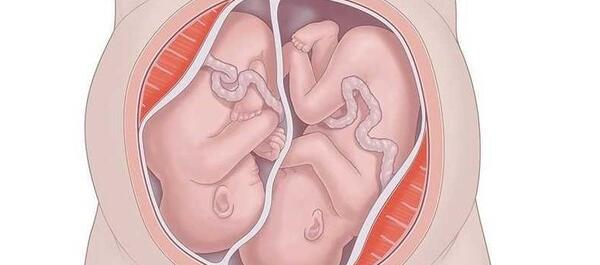 عکس بچه کوچولو های دوقلو
