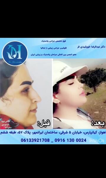 عکس پریا عرب زاده قبل از عمل