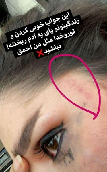 عکس دنیا جهانبخت و نامزدش