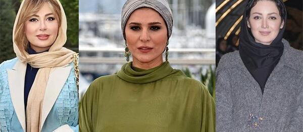 عکس الناز شاکردوست قبل از عمل دماغ