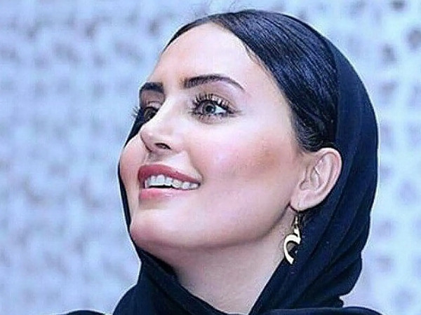 عکس الناز شاکردوست قبل از عمل دماغ