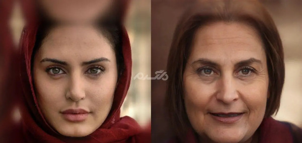 عکس الناز شاکردوست قبل از عمل دماغ