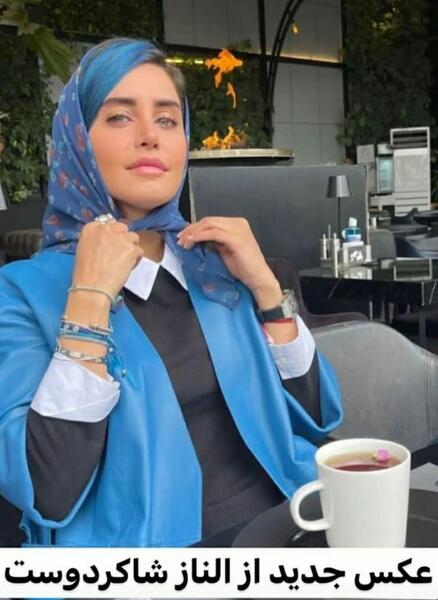 عکس الناز شاکردوست قبل از عمل دماغ