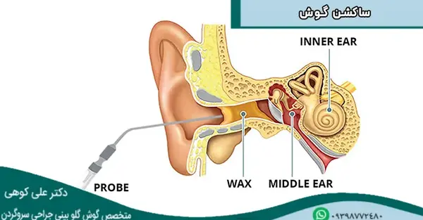 عکس توی گوش