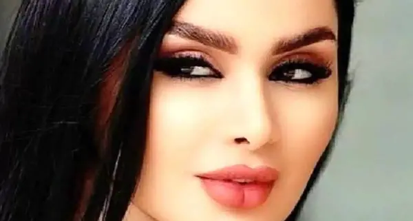 عکس دنیا جهانبخت قبل از عمل زیبایی