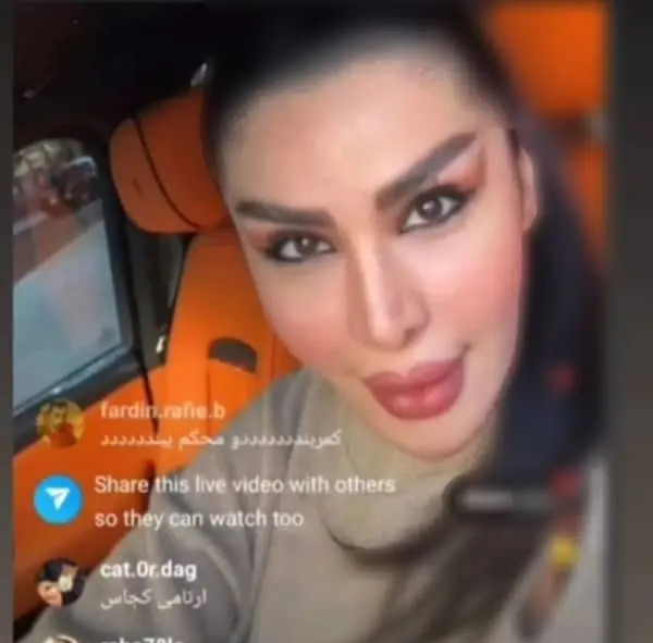 عکس دنیا جهانبخت قبل از عمل زیبایی