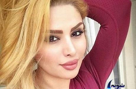 عکس دنیا جهانبخت قبل از عمل زیبایی