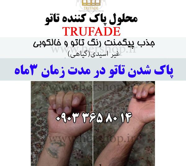 عکس تاتو دست چگونه پاک میشود