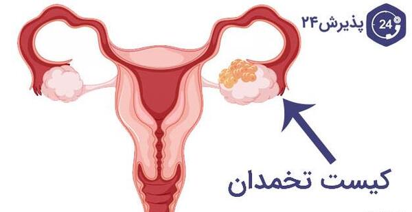 عکس داخل رحم دختر