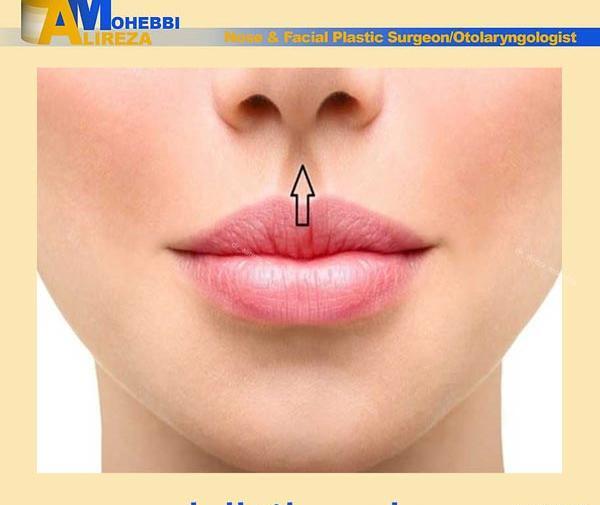 عکس ایده زیبایی لب