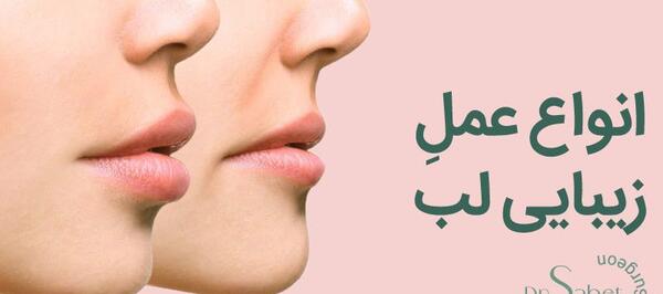 عکس ایده زیبایی لب