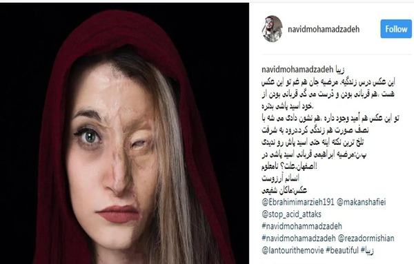 عکس زهرا محمدزاده