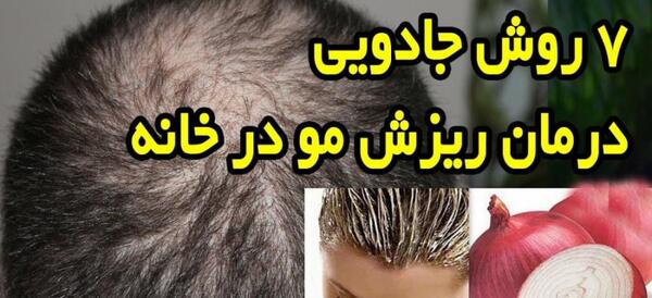 عکس دختر ریزش مو