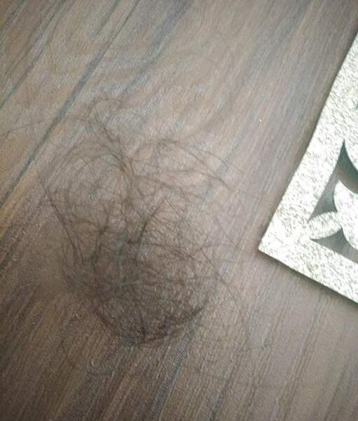 عکس دختر ریزش مو