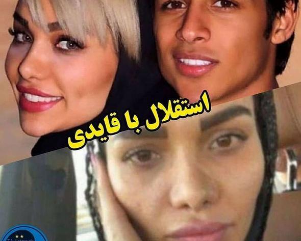 عکس ستاره معصومی قبل از عمل