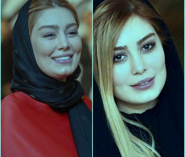 عکس سحر ساغرچی قبل از عمل