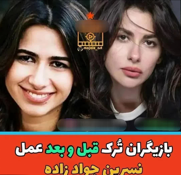 عکس سحر ساغرچی قبل از عمل
