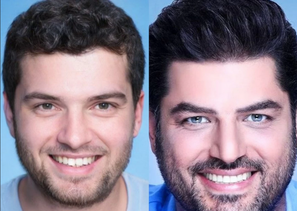 عکس صورت سام درخشانی