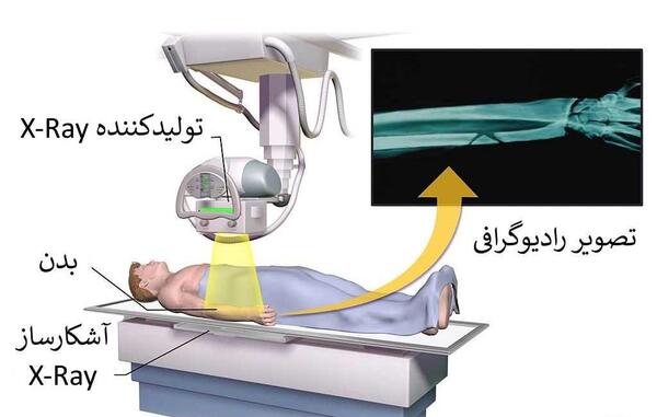 عکس رنگی ریه