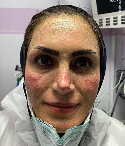 عکس ایرانی صورت