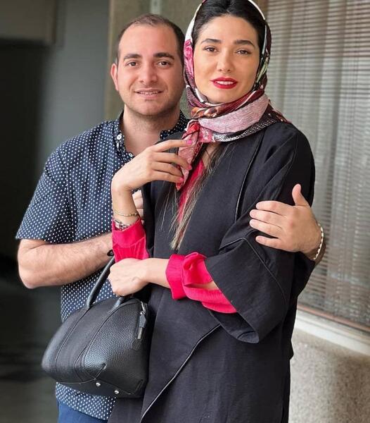 عکس مینا وحید قبل از عمل
