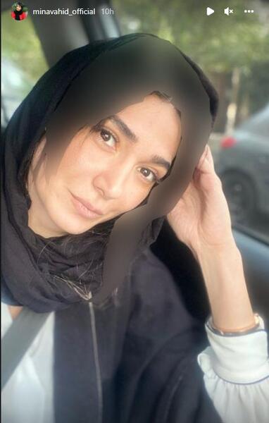 عکس مینا وحید قبل از عمل