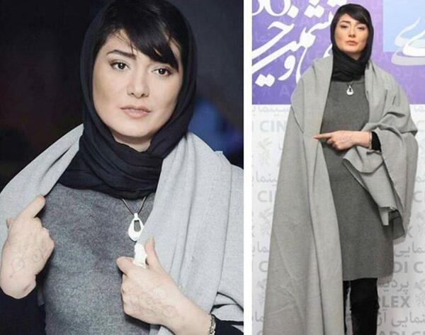 عکس مینا وحید قبل از عمل