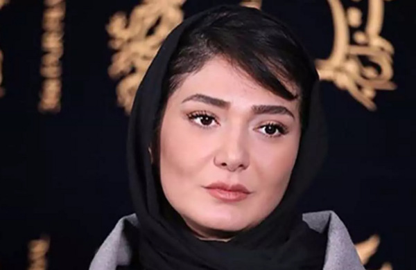 عکس مینا وحید قبل از عمل