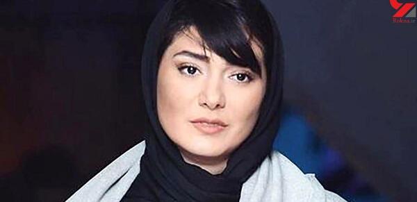 عکس مینا وحید قبل از عمل