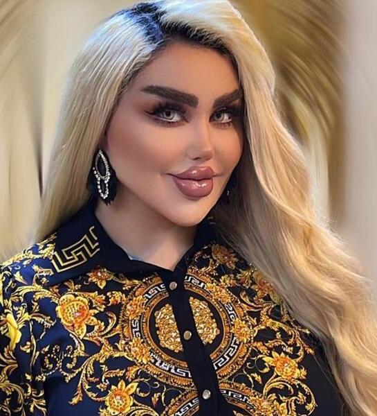 عکس تارا قبل از عمل
