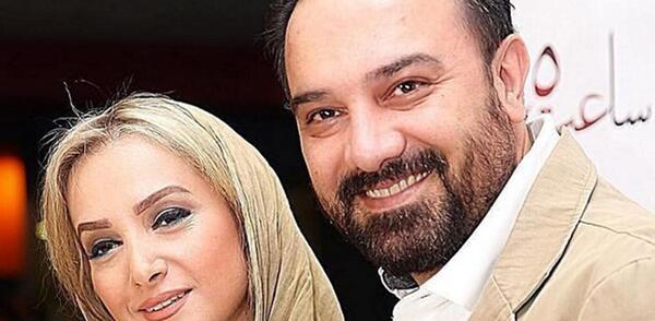 عکس برزو ارجمند قبل از عمل بینی