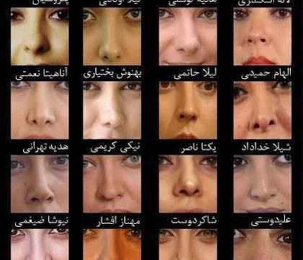 عکس برزو ارجمند قبل از عمل بینی