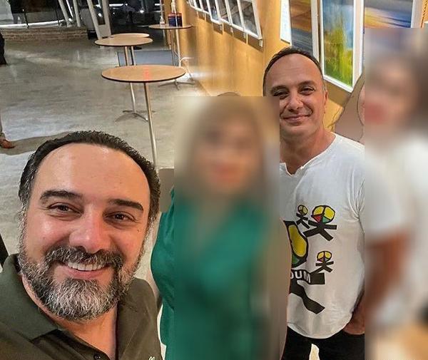 عکس برزو ارجمند قبل از عمل بینی