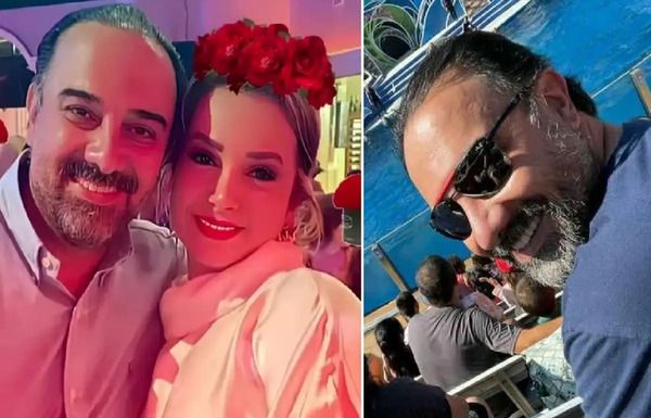 عکس برزو ارجمند قبل از عمل بینی
