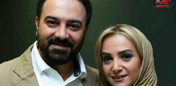 عکس برزو ارجمند قبل از عمل بینی