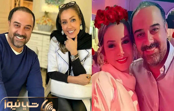 عکس برزو ارجمند قبل از عمل بینی