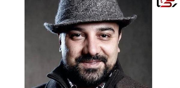 عکس برزو ارجمند قبل از عمل بینی