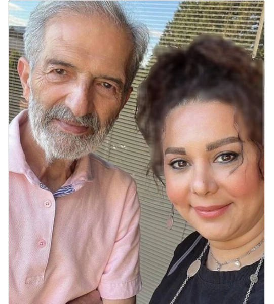 عکس برزو ارجمند قبل از عمل بینی