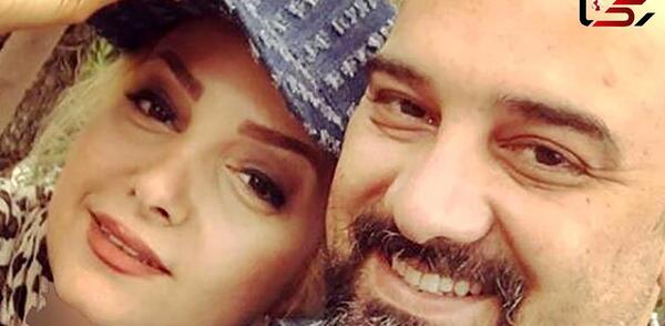 عکس برزو ارجمند قبل از عمل بینی