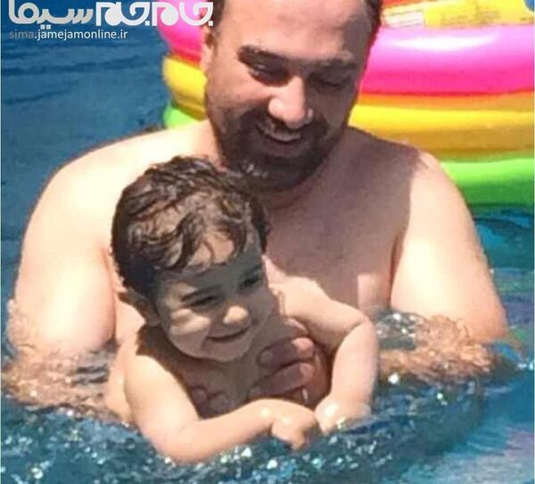 عکس برزو ارجمند قبل از عمل بینی