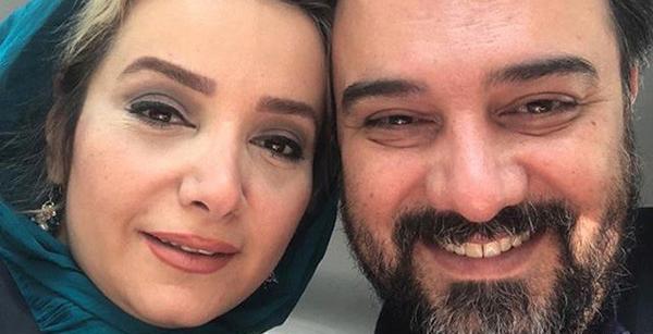 عکس برزو ارجمند قبل از عمل بینی