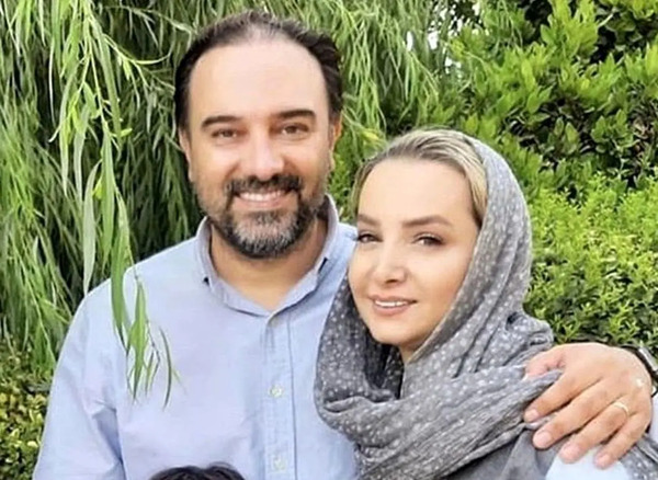 عکس برزو ارجمند قبل از عمل بینی