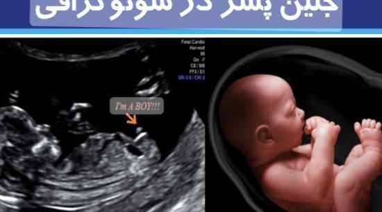 عکس مریم امینی